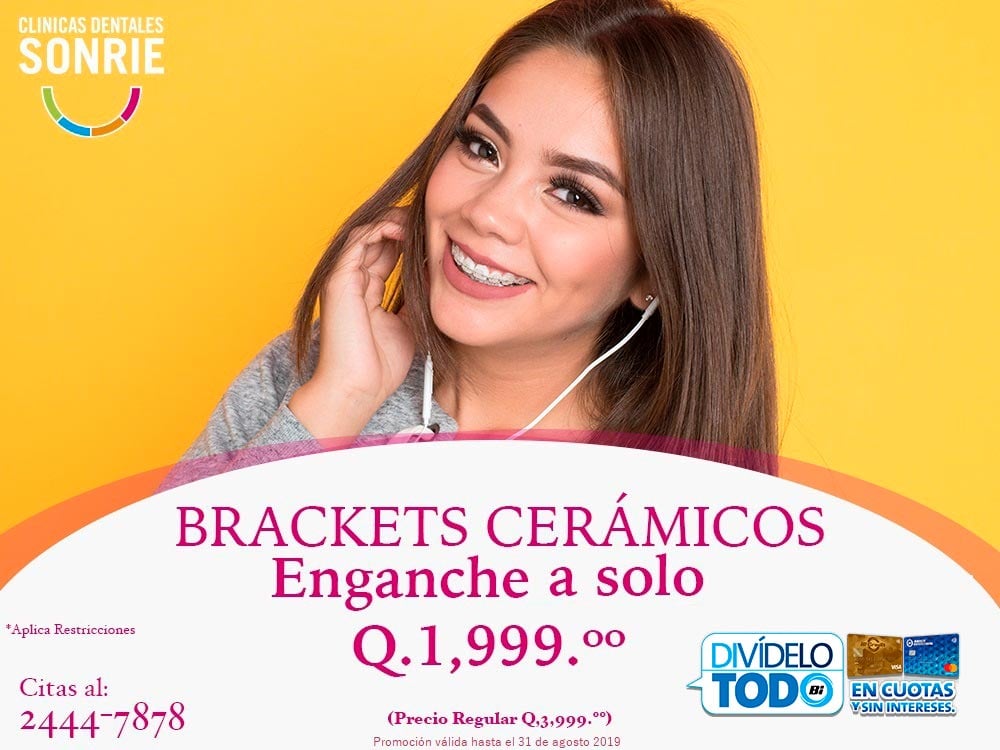 SONRIE BRAQUETS CERAMICOS